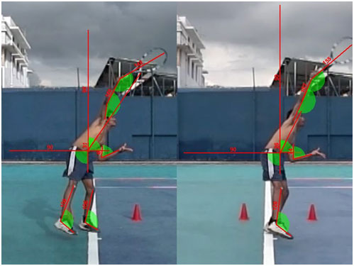 epic sports biomechanics